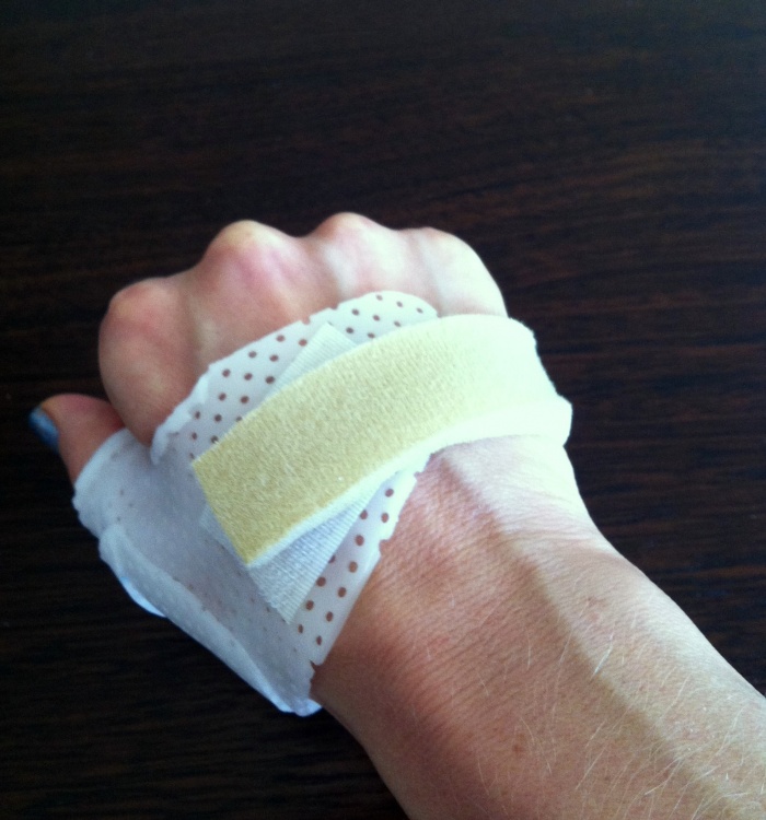 Splint - Thumb Deal